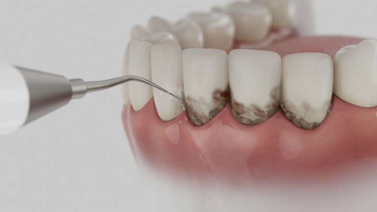 Reliable Dental Implants contractor in Dadeville, AL by Smile Center Dentistry